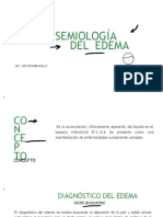 Semiología Del Edema