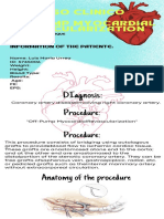 Caso Clinico Off Pump Myocardial Revascularization