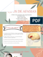 Tipos de Afasia