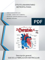 Fibrilacion Ventricual