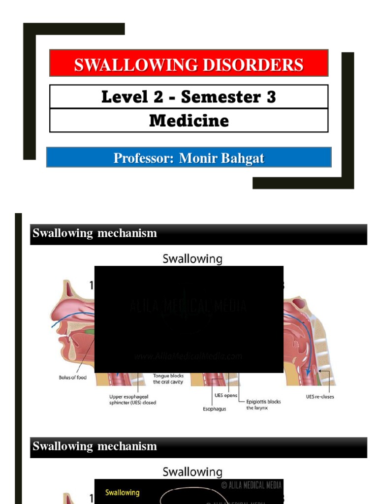 Understanding Dysphagia: Causes and Treatment | PDF | Esophagus ...