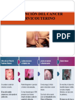 Prevención Del Cancer Cervicouterino