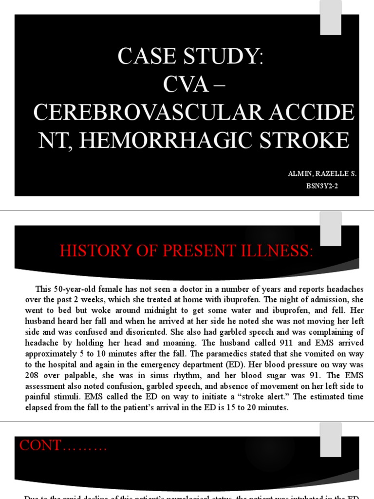 Cva Cascade Xt The Shocking Problems You Need To Know - siwbwmj