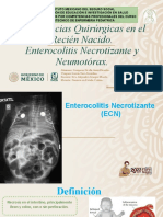Enterocolitis y Neumotorax