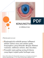 KONJUNGTIVITIS