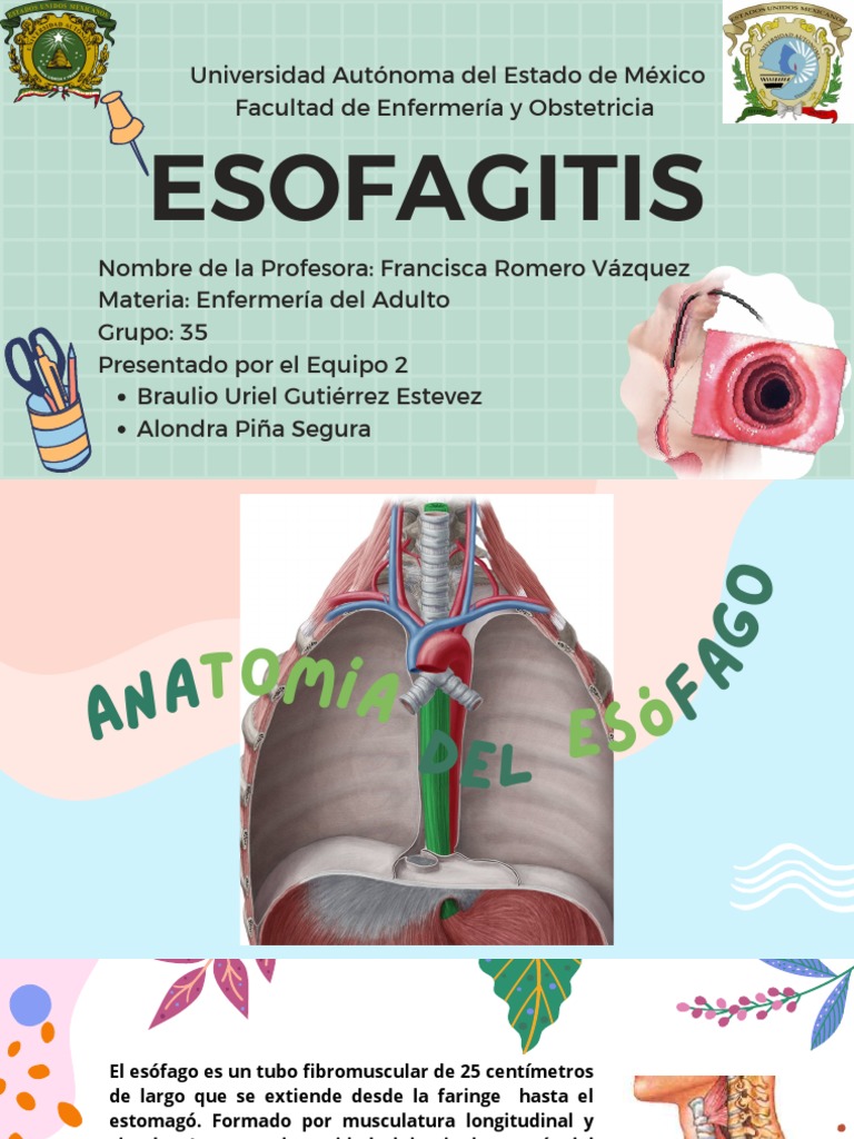 Anatomía y Tratamiento de la Esofagitis | PDF | Estómago | Esófago