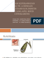 Cholelitiasis