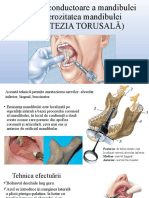 Anestezia Torusală + Infraorbitală+Mandibulara+ Incisiva + Tuberala+Palatinala