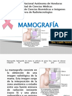 Generalidades Mamografia, Cáncer de Mama