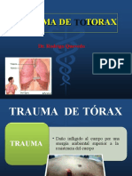 Trauma de Torax