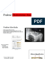 Upper Extremity Fracture (Minus Distal Radius and Hand)