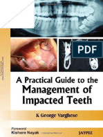 Mang of Impacted Teeth
