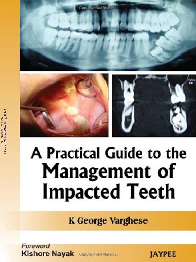 Mang of Impacted Teeth | PDF | Dentistry | Oral And Maxillofacial Surgery