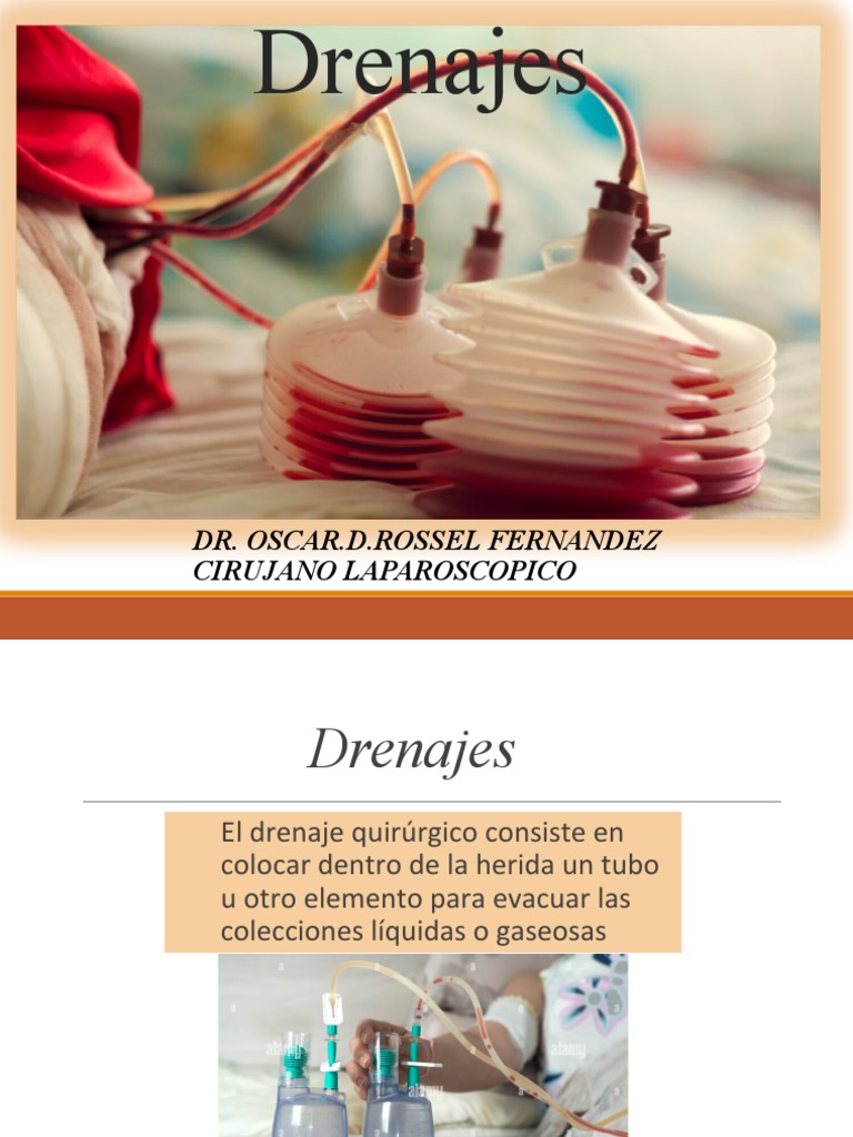 Tipos y Mecanismos de Drenaje Quirúrgico | PDF | Herida ...