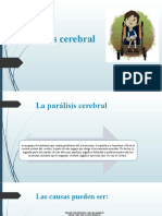 Paralisis Cerebral