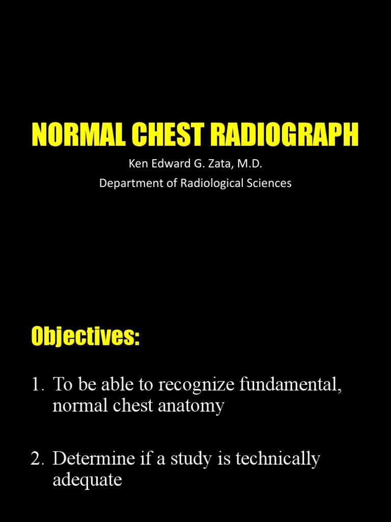 Normal Chest Radiograph REVISED | PDF | Atrium (Heart) | Thorax