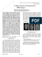 DenseNet For Brain Tumor Classification in MRI Images