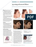 Nose Reshaping Using Advanced Fillers