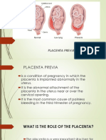 Placenta Previa and Abruptio Placenta Guide