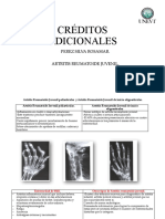 Artritis Reumatoide Juvenil