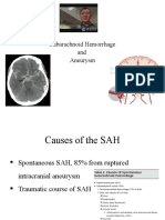 SAH & Aneurysm