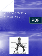 Tuberculosis Pulmonar