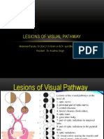 Lesions of Visual Pathway NOTICE BOARD