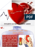 69 - Presentacion Infarto