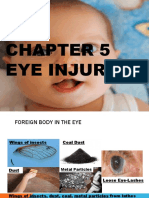 Eye Injury (5,6)