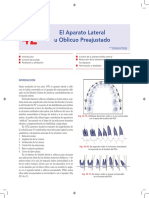 Aparato Lateral U Oblicuo Preajustado