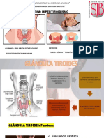 HIPERTIROIDISMO