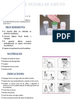 Toma de Muesra de Esputo