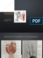 Carotidas Extracerebral