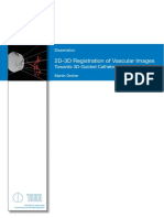 2D-3D Registration of Vascular Images: Towards 3D-Guided Catheter Interventions