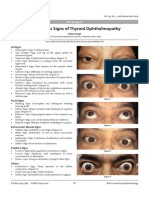 Eponymous Signs of Thyroid Ophthalmopathy