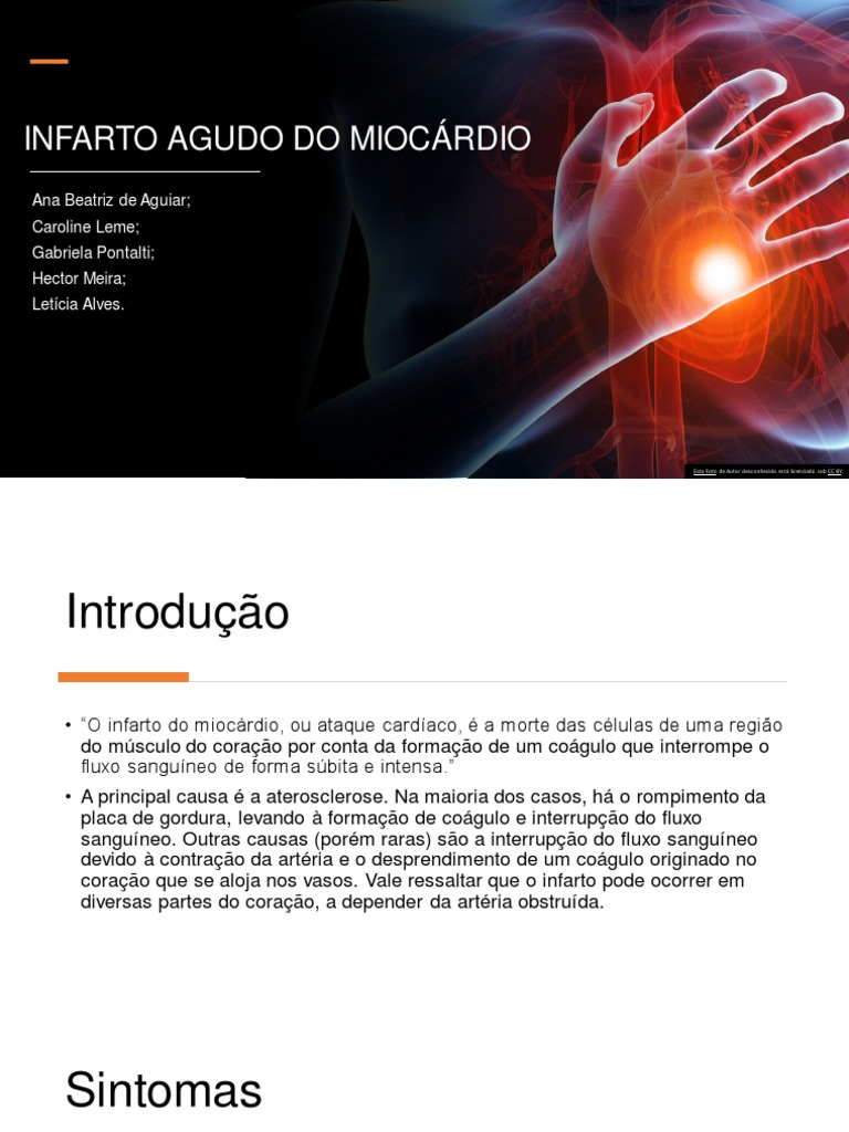 Como Acontece O Infarto? : Infarto do miocárdio: sintomas, causas ...