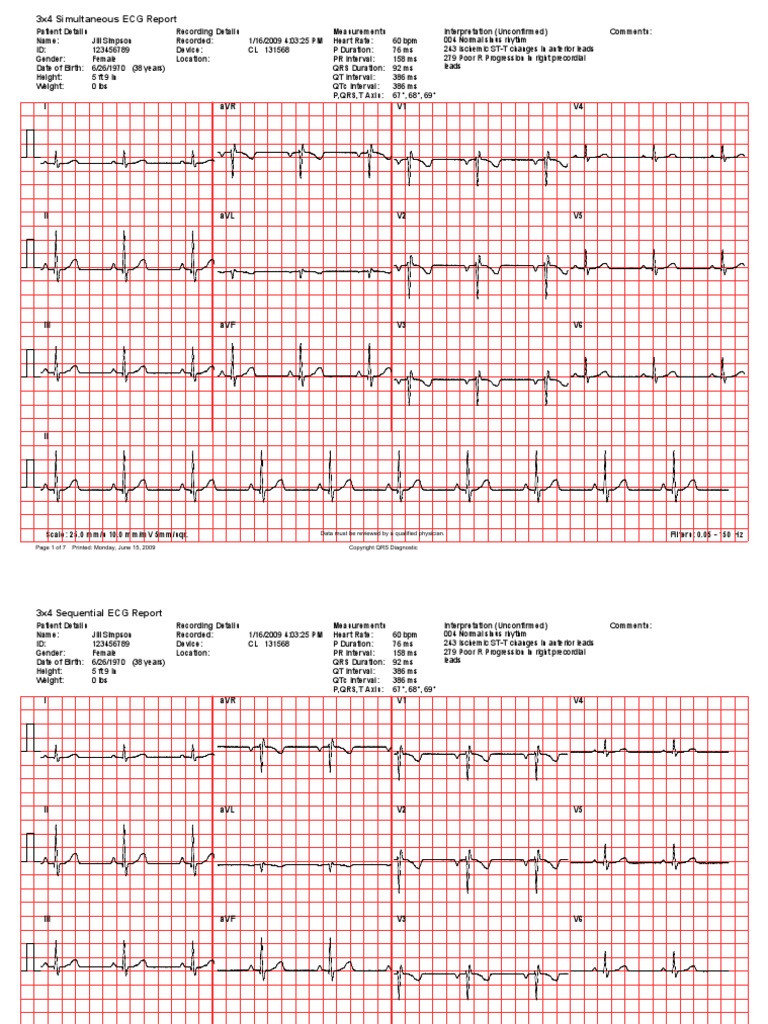 ecg lab report hypothesis