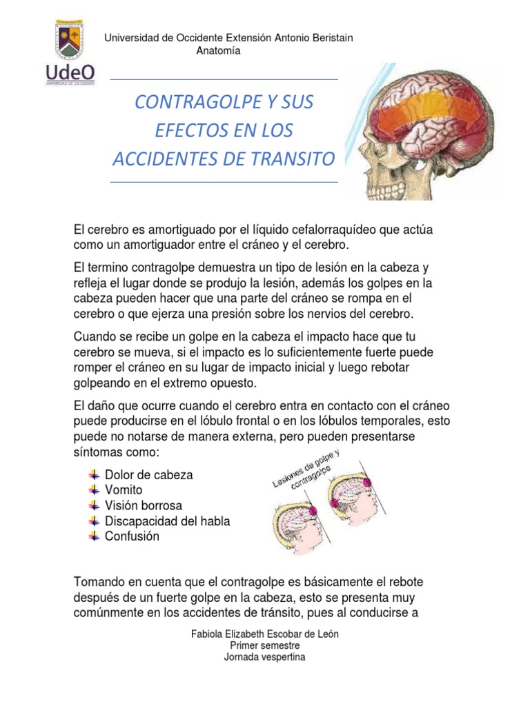 Contragolpe y Sus Efectos en Los Accidentes de Transito | PDF | Cerebro ...
