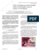 Osteomyelitis of The Left Humerus With Secondary Septic Arthritis of TheShoulder Joint in Neonate A Case Report