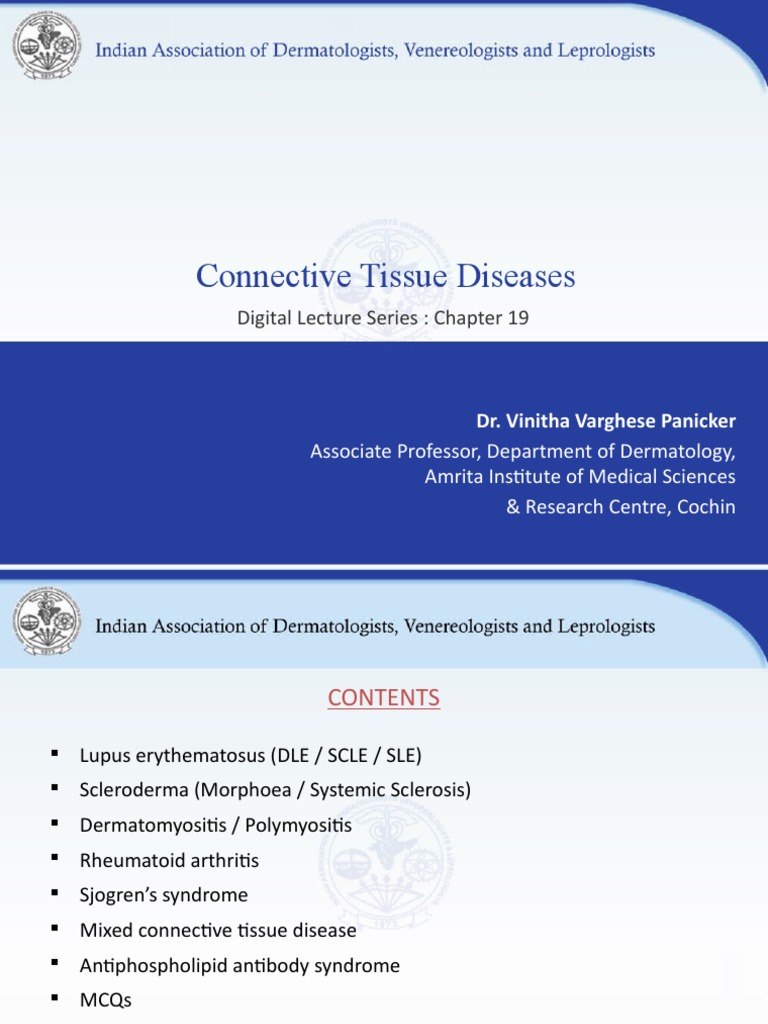 Connective Tissue Diseases PDF Immunology Medical Specialties