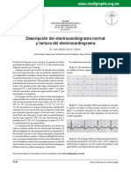 Descripción Del Electrocardiograma Normal