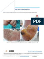 Galeria de Imagenes Dermatopatologia