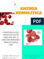 Anemia Hemolítica