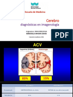 Clase Cerebro Flair