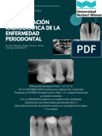 Interpretación Radiográfica de La Enfermedad Periodontal