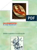 Vu Lvo Vaginitis