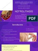 Nefrolitiasis