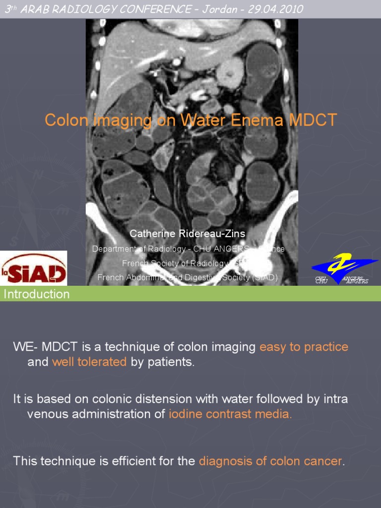 Colon Imaging Download Free PDF Colorectal Cancer Radiology
