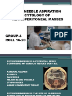 Fnac of Peritoneum