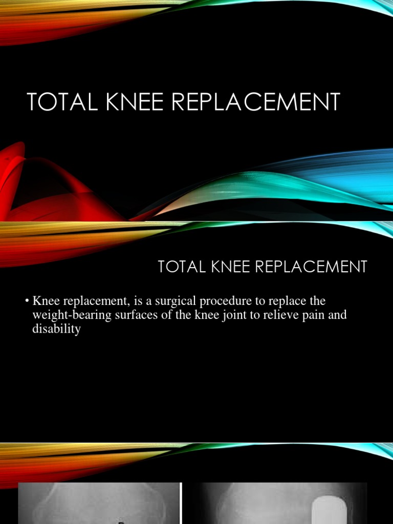 Total Knee Replacement Overview Guide | PDF | Knee | Musculoskeletal System